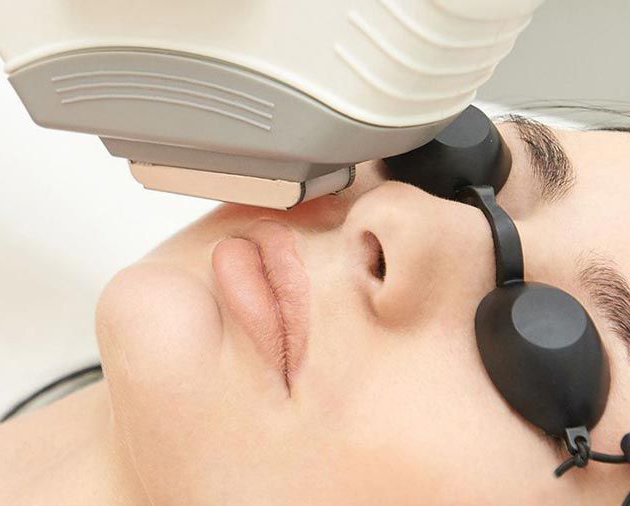 Triệt Ria Mép Tại Sen Beauty